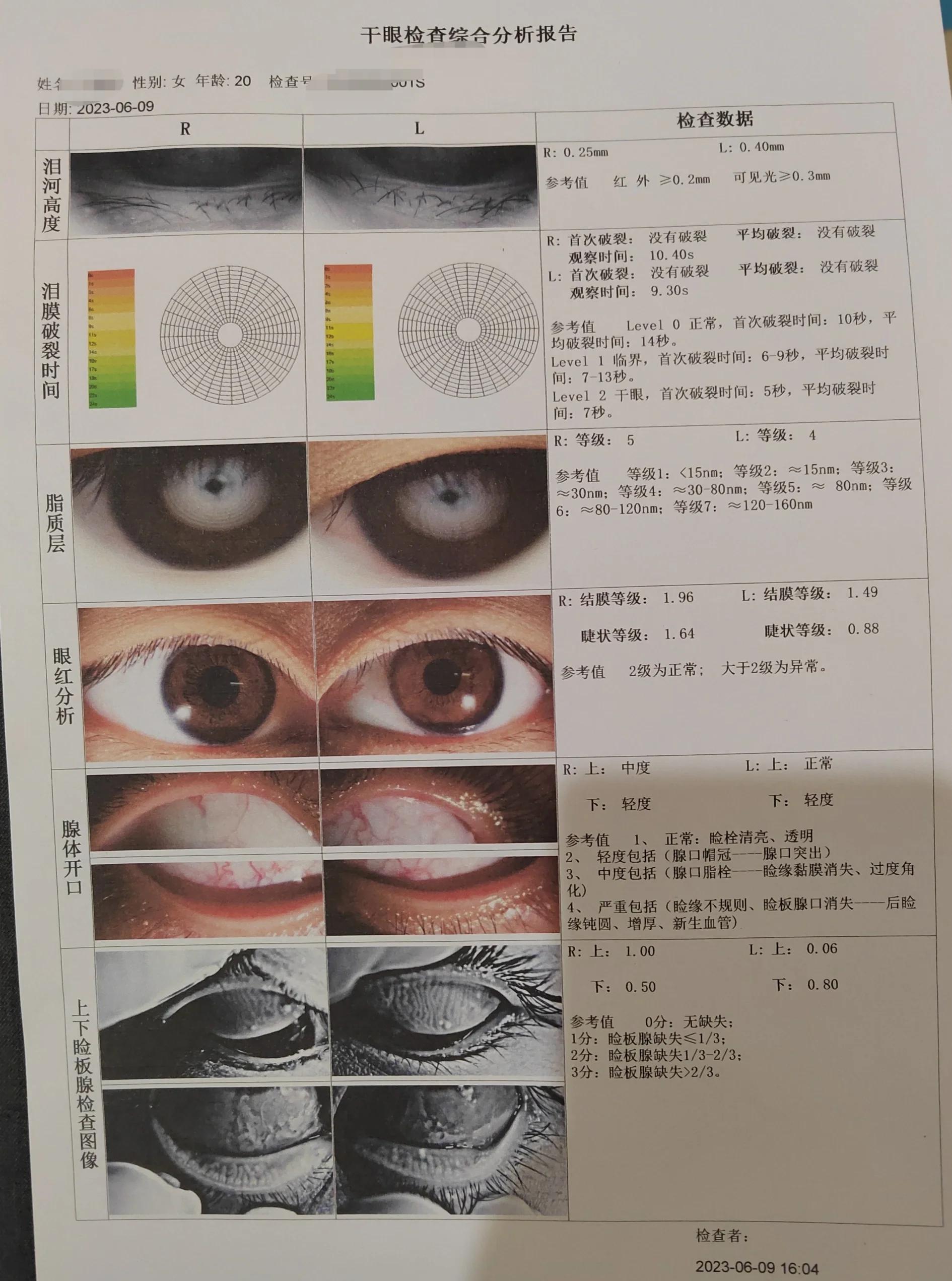 眼科医院才是首选