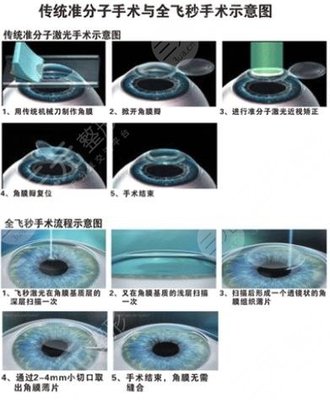 深圳十大眼科医院近视排名更新