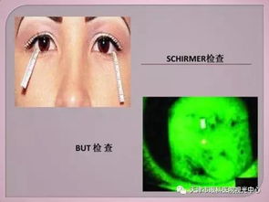 天津市眼科医院 假期警惕干眼