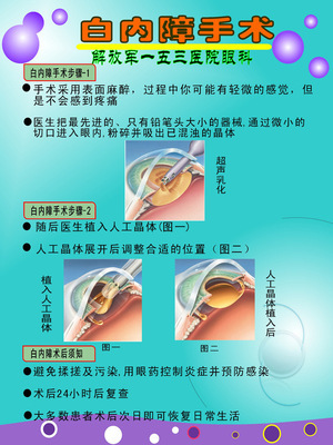 白内障手术——守护光明，重拾清晰视界